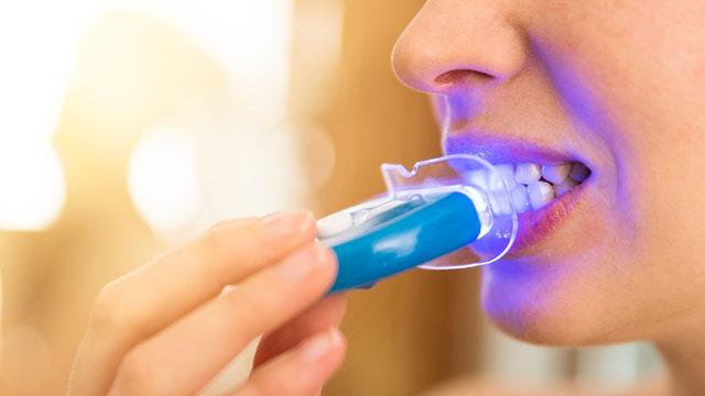 Evde diş beyazlatma işlemi dönüşü olmayan hasarlara yol açabilir!