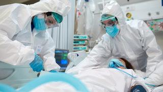 Doç. Dr. Ümit Savaşçı: Covid-19 geçirenlerin beyninde küçülme tespit edildi