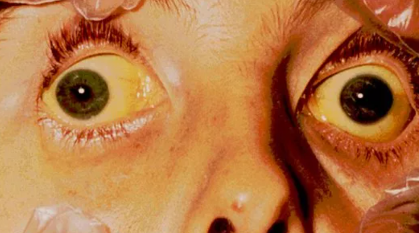 Tarihin en çılgın doktoru! Teorisini kanıtlamak için hastalarını kusmuğunu içen doktor: Stubbins Ffirth