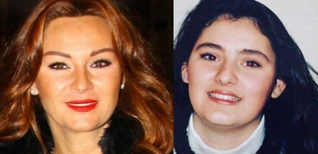 Pınar Altuğ’un estetiksiz halini görenler oyuncuyu tanıyamadı