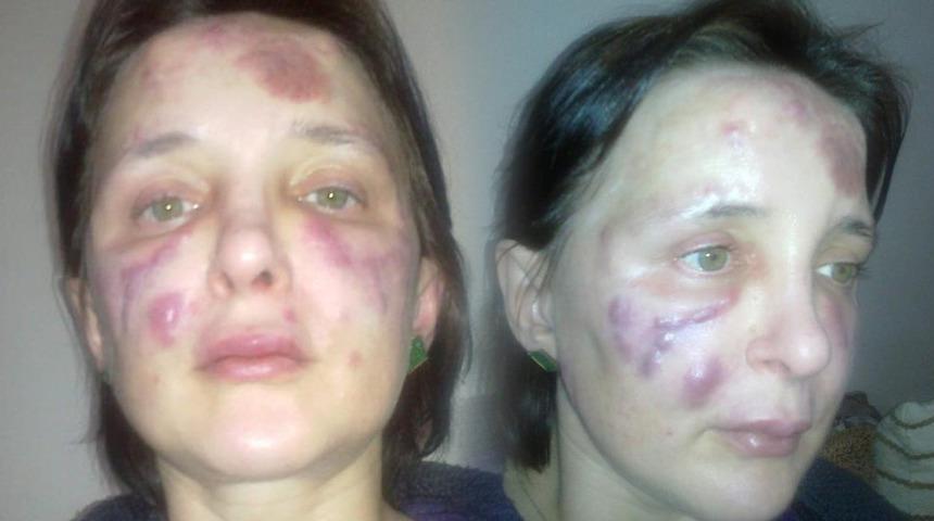 Estetik faciası! Kadını tanınmaz hale getiren sahte doktor hakkında karar