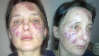 Estetik faciası! Kadını tanınmaz hale getiren sahte doktor hakkında karar