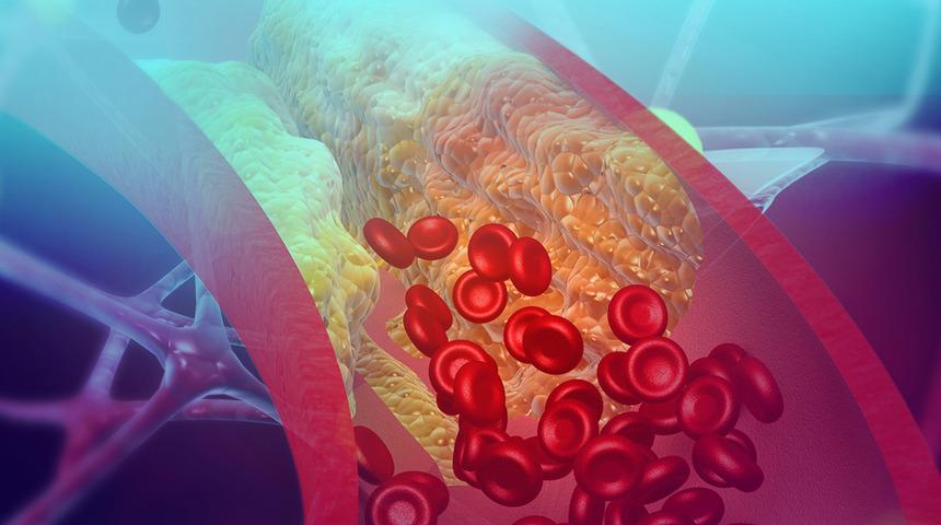 Damar tıkanıklığına iyi gelen bitkisel karışımlar ölüme neden oluyor!