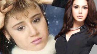 Yaptırdığı estetik ameliyatlar yüzünden tanınmaz hale gelen Ceylan, hastanelik oldu