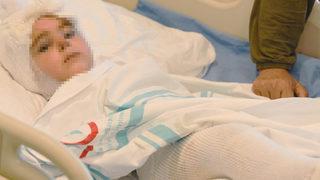 Tandıra düşen 2 yaşındaki Eylül ölümden döndü