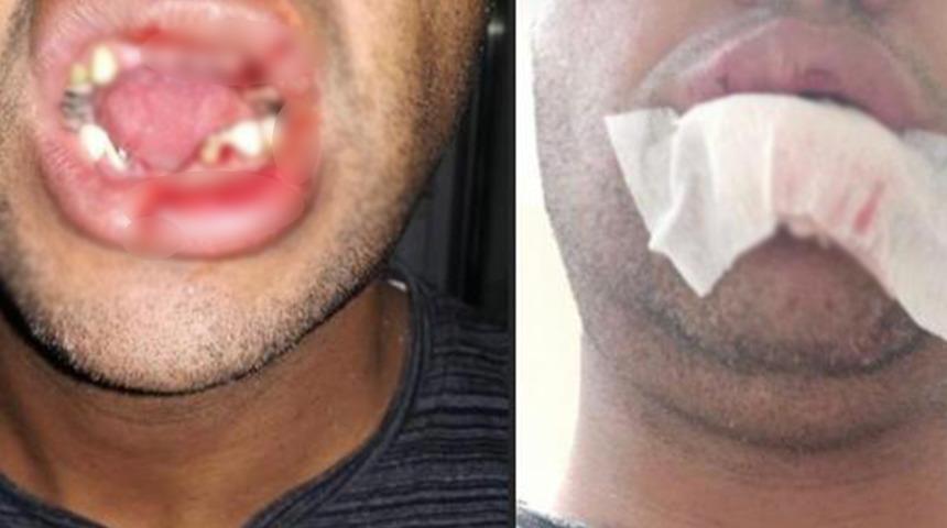 Yer: Şanlıurfa! İnek, veterinerin çenesi ve dişlerini kırdı