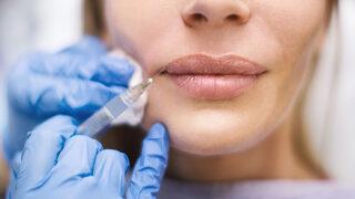 Dudak dolgusu kalıcı bir işlem midir?