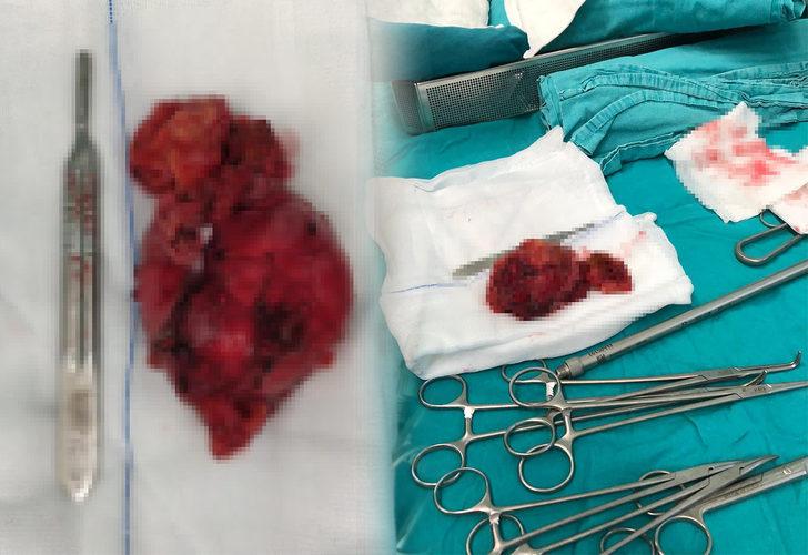 Kalp krizi sanılarak anjiyo oldu ama gerçek bambaşka çıktı G2