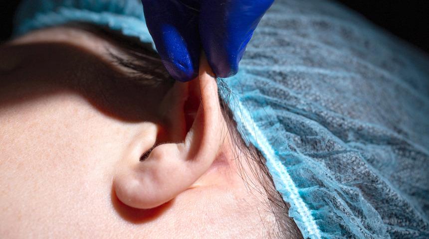 Kepçe kulak ameliyatı ile istenilen görünüme kavuşmak mümkün