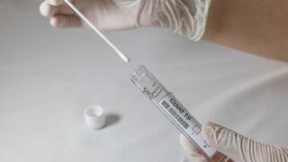 PCR ve antijen testi için yeni yöntem geliştirildi! Sürüntü yerine gargara ile örnek alınıyor