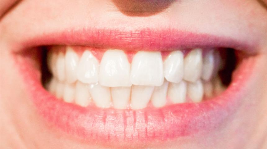 Uçuk nedenleri ve tedavi yöntemleri