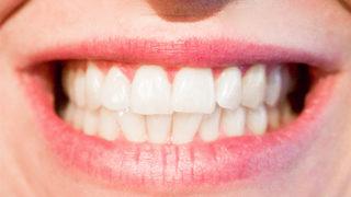 Uçuk nedenleri ve tedavi yöntemleri