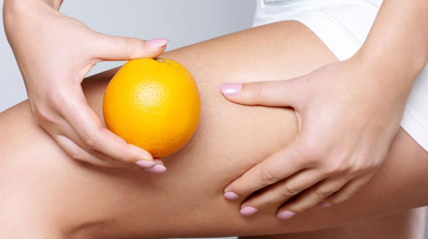 Selülit tedavisinde mezoterapi uygulaması