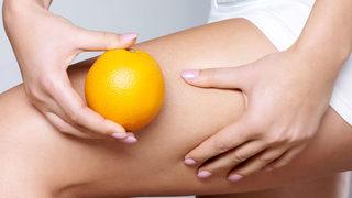 Selülit tedavisinde mezoterapi uygulaması