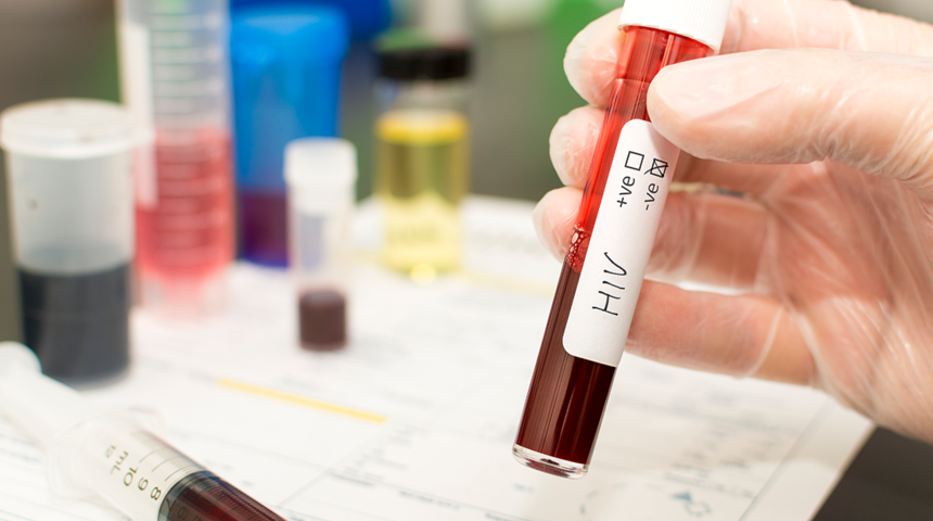 Dakikada 10 kişi AIDS'e yakalanıyor