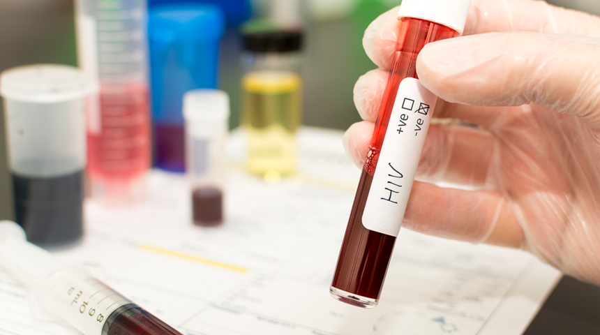 AIDS'e karşı vajinal jel! Kadınların korunması için Afrika'da başladı