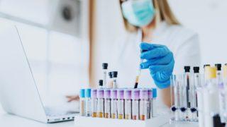 AIDS, Doğu Avrupa ve Orta Asya'da yayılıyor