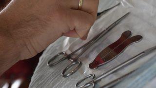 Uzman isim uyardı: Sünneti mutlaka cerrahi yöntemlerle yaptırın