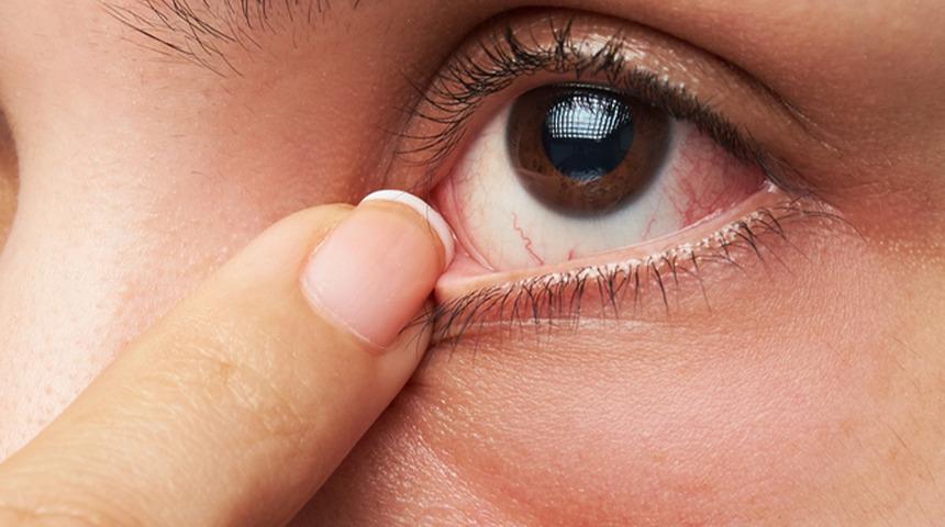 Dinmeyen ağrıları nedeniyle hastaneye gitti, göz kapağının düşme nedenini duyunca şaşkına döndü