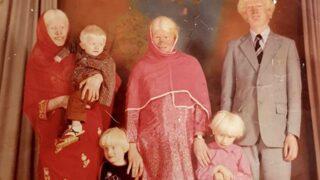 Guinness rekortmeni olmuşlardı! Dünyanın en büyük albino ailesi taciz ve ev saldırılarına uğradığını itiraf etti