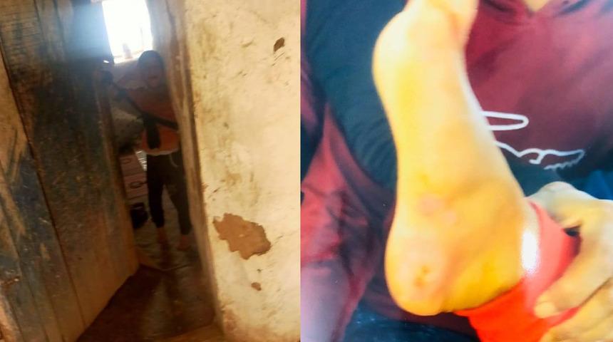 Şanlıurfa'da akılalmaz olay! "Eşim engelli oğlumu iple bağlayıp işkence ediyor"