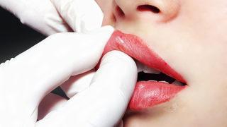 İğnesiz dolgu nasıl yapılır? İğnesiz dolgu nerede satılır, fiyatı ne kadar?