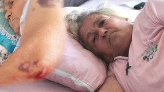 Akılalmaz iddia: Hastaneye yürüyerek girdim, sakat çıktım