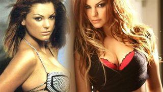 'Türk Lokumu' lakabıyla bir dönem piyasaları kasıp kavuran Nez, estetiğin dozunu kaçırdı! Gören tanıyamadı!