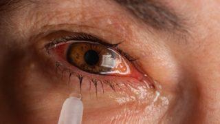 Gözlerde alerjiye dikkat