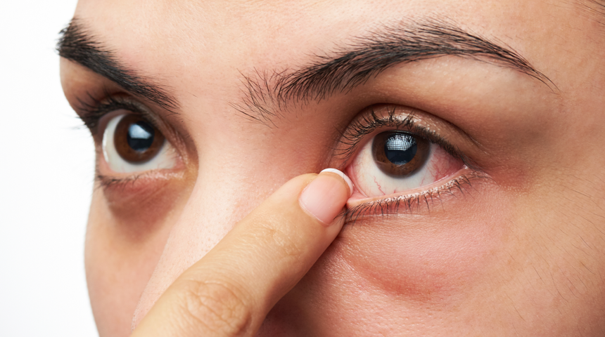 Kış aylarında gözlerimizi nasıl korumalıyız?