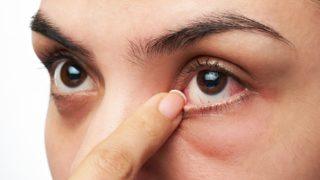 Kış aylarında gözlerimizi nasıl korumalıyız?