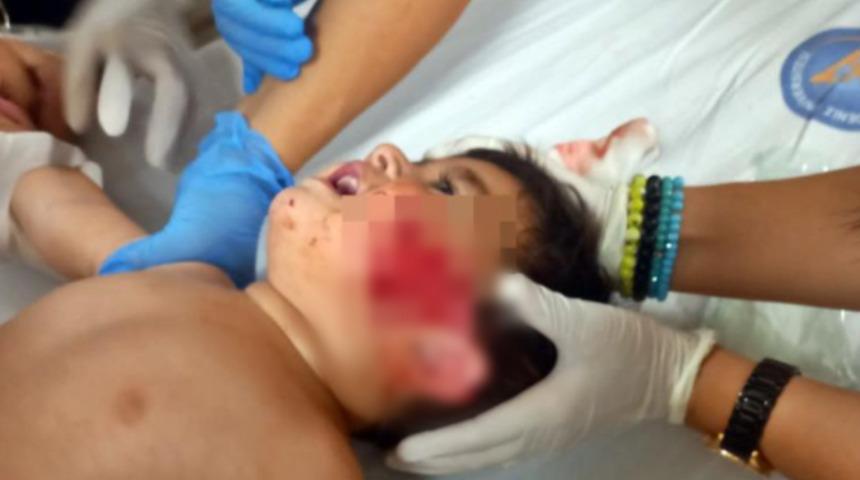 Pitbull dehşeti! 11 aylık bebeğin kulağını ve yanağını kopardı: Elmacık ve çene kemiği görünüyordu