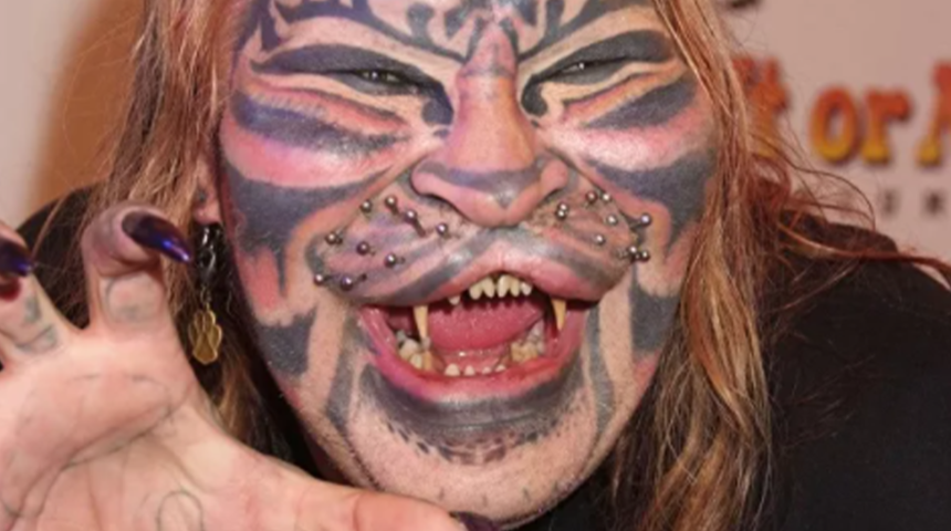 Kediye benzemek için defalarca kez ameliyat olmuştu! Dennis Avner’in sıradışı hayatı sizleri şaşırtacak