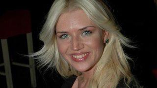 Ünlü manken estetiğe kafa tutmuş! Kulaklarına yaptığını duyunca şaşıracaksınız…