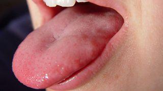 Dilinize bakarak hastalığı anlayın