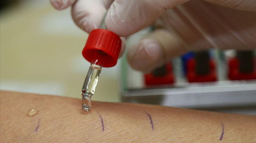 Toplum'da 5 kişiden 1'i alerjik