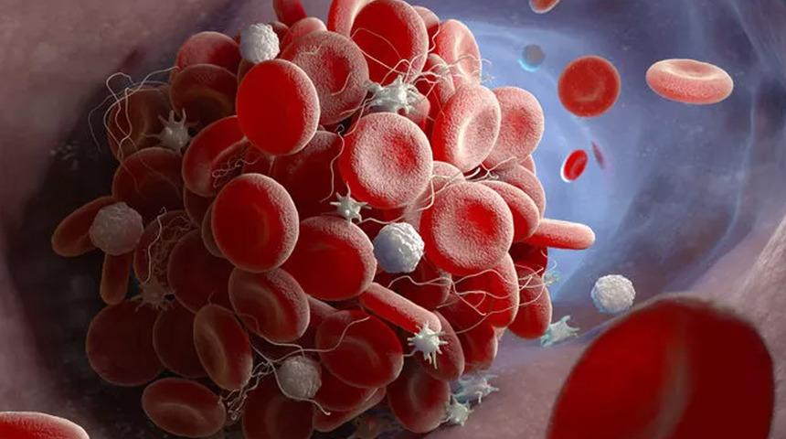 Akdeniz anemisinde erken tanı önemli