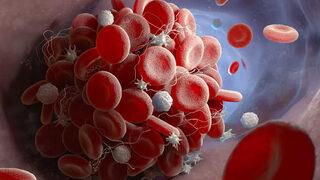 8 Mayıs Dünya Talasemi Günü