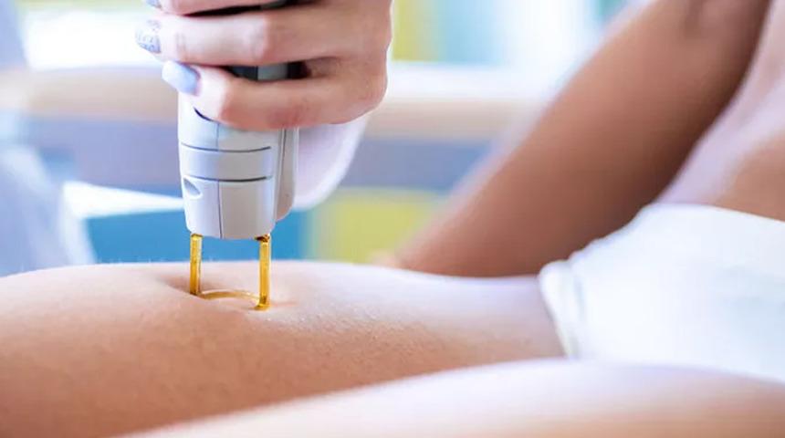 Lazer nedir, nasıl yapılır?