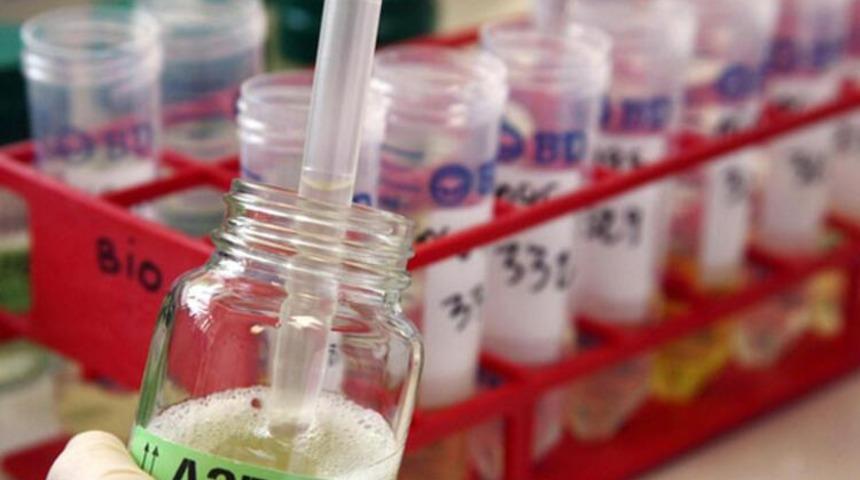 Doping testlerinde hata ihtimali  