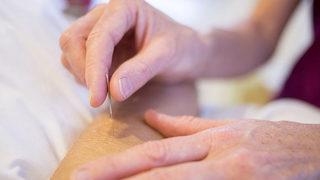 Akupunktur nedir, biliyor musunuz?