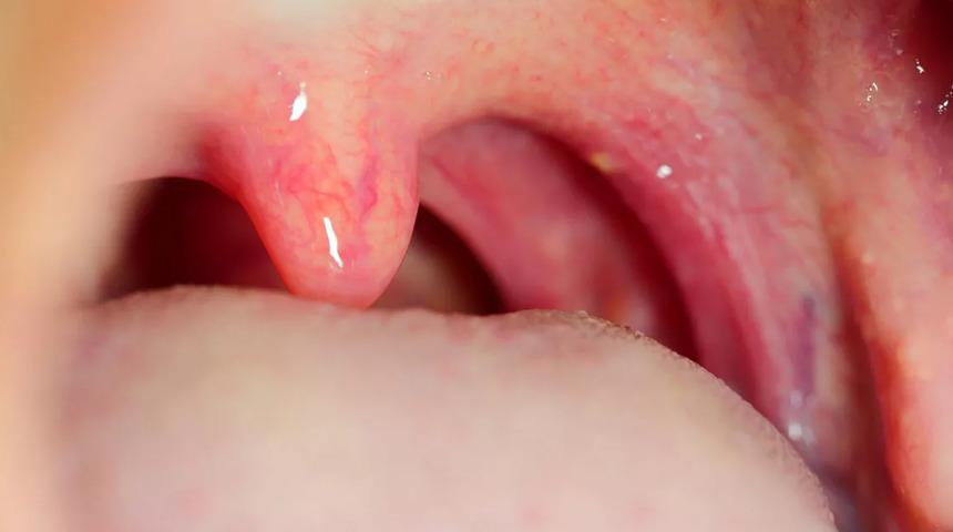 Bademcikler vücudun bekçisi