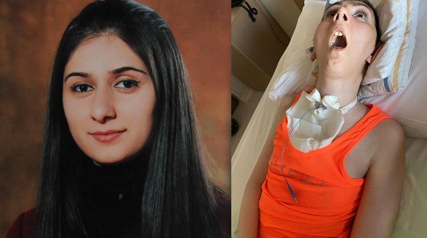 Estetik ameliyat hayatını kararttı! 2 çocuk annesi kadın yatağa bağımlı kaldı