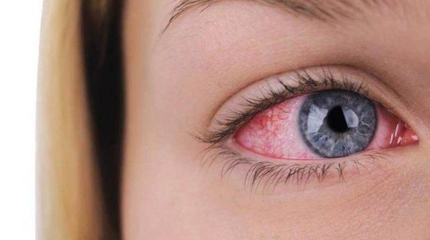 Glakom nedir, tedavisi nasıl? 