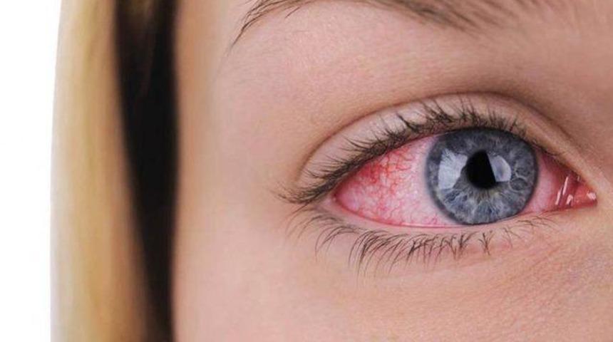 Gözlük ve lenslere son: Göz lazer ameliyatı