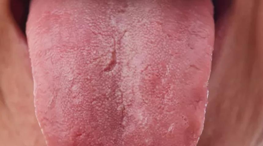 Ramazan'da ağız kuruluğu