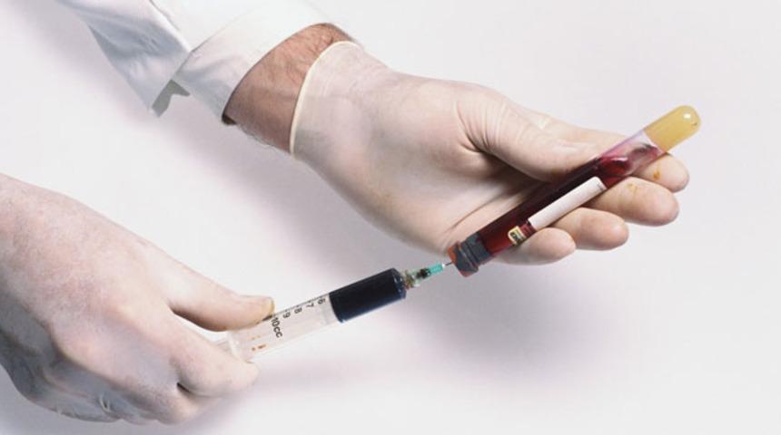 5 milyon kişi hepatit virüsü taşıyor