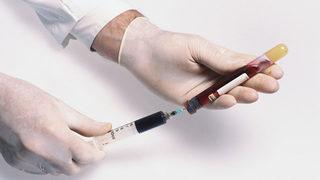 5 milyon kişi hepatit virüsü taşıyor