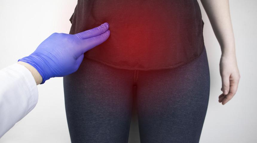 Düzensiz kanamalar miyom işareti olabilir