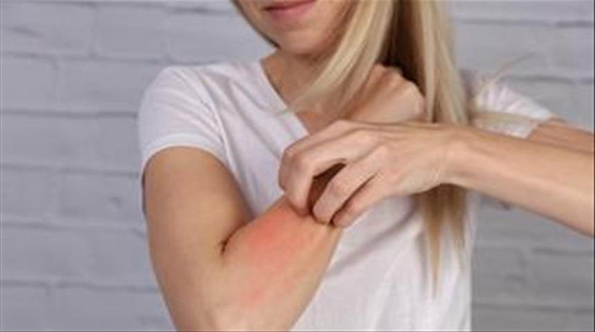 Dikkat! Lateks alerjiniz olabilir